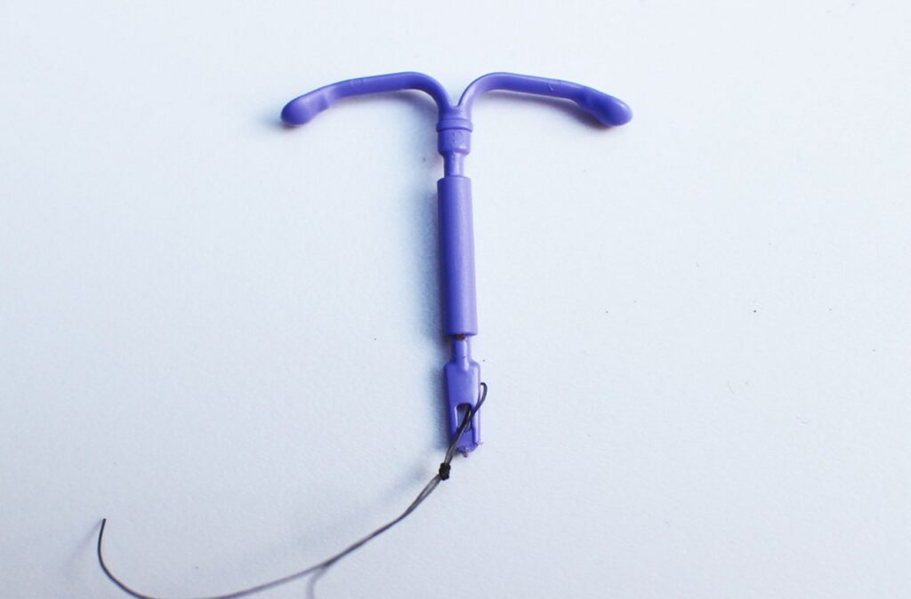 Hormonal IUD